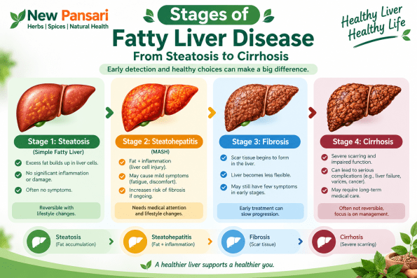 Stages of Fatty Liver Disease: From Steatosis to Cirrhosis